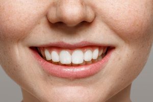 5 Tricks für schneeweißes Lächeln. Was ist zu tun, um weiße Zähne zu bekommen?